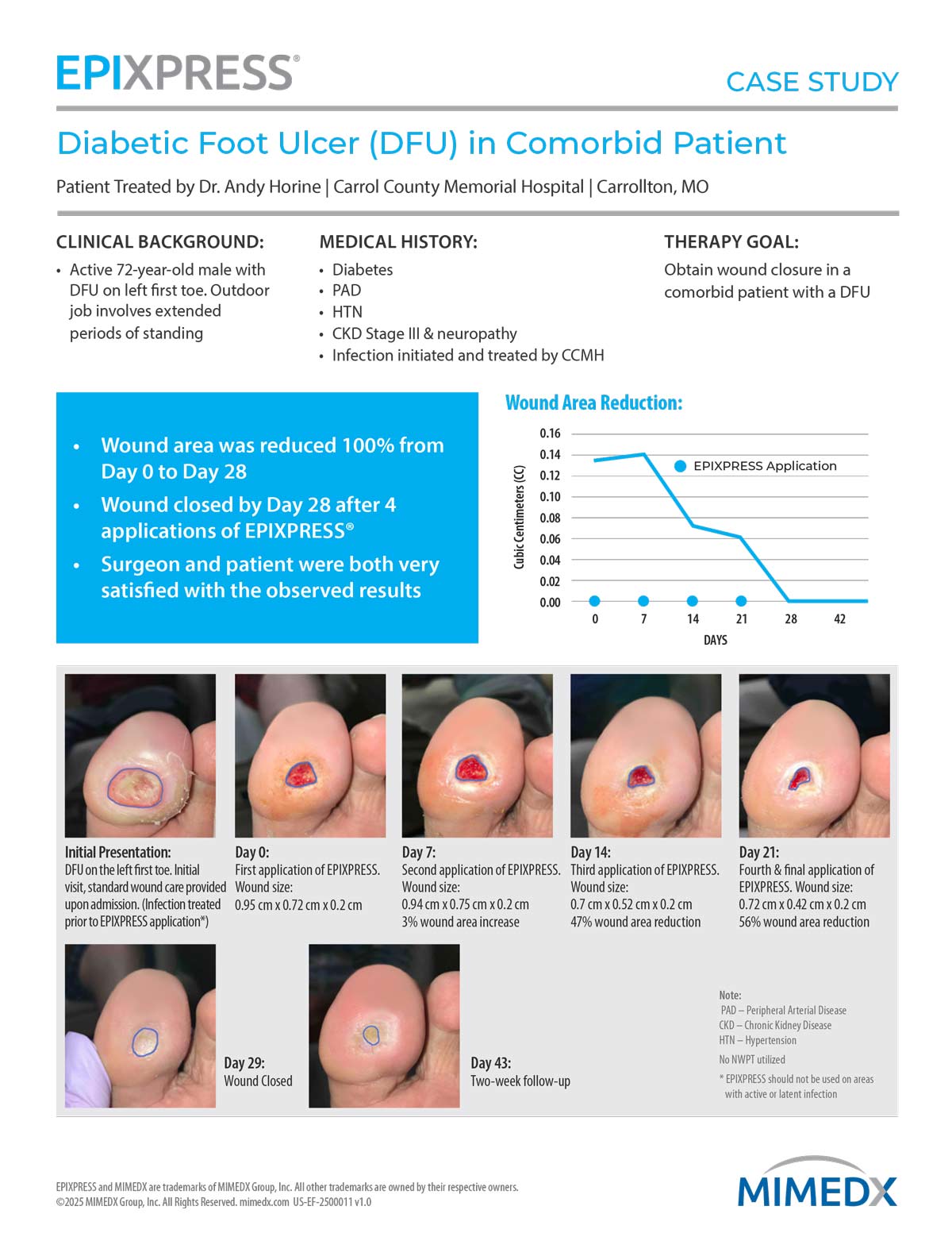 EPIXPRESS-Case-Study---DFU-in-Comorbid-Patient