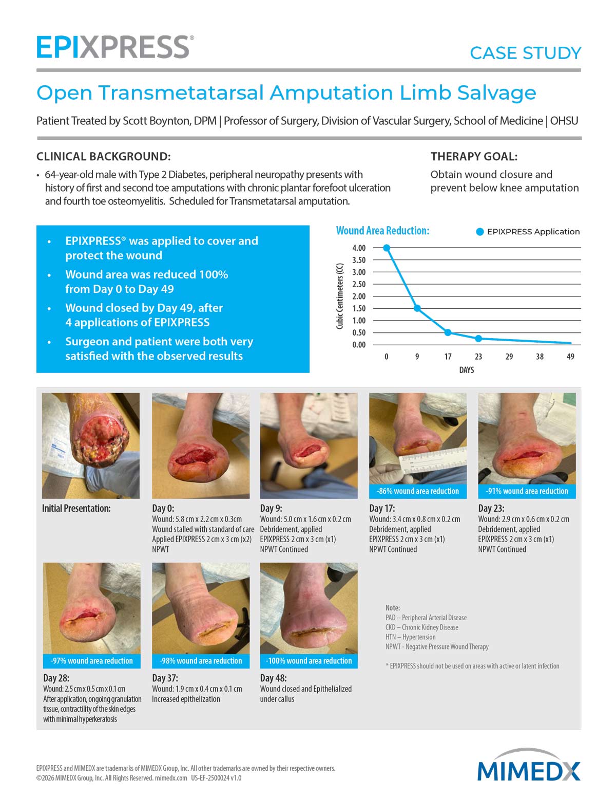EPIXPRESS-Case-Study---Open-Trans-metatarsal-Amputation-Limb-Salvage