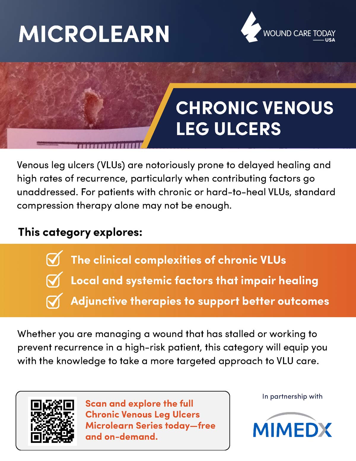 MIMEDX-Webinar-Microlearn-Flyer_Page_1